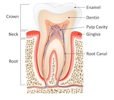 Image of diagram displaying enamel erosion, tuscaloosa al
