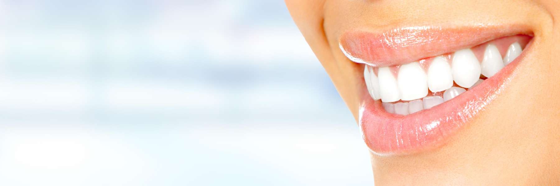 Close up of smile after dental crowns, tuscaloosa al