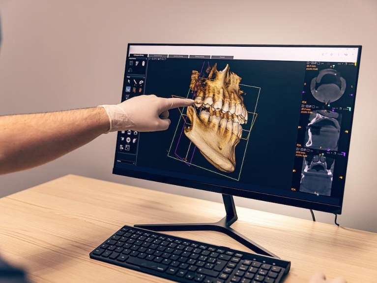 CBCT Cone Beam Technology at vandervoort family dentistry, tuscaloosa al