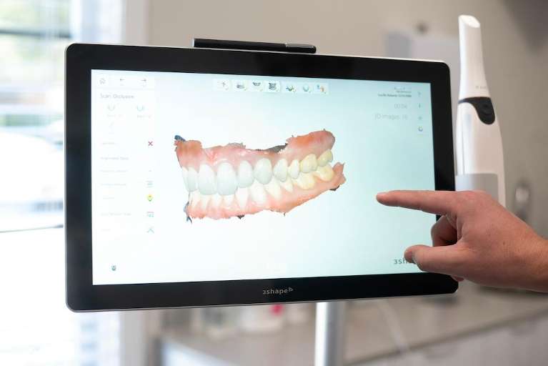 Digital Impressions in Vandervoort Family Dentistry