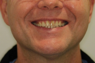 Vandervoort Family Dentistry
