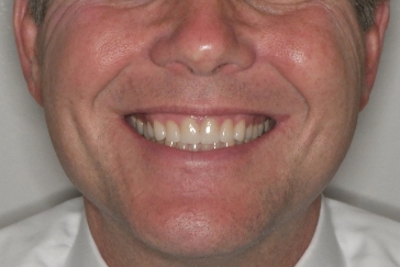 Vandervoort Family Dentistry